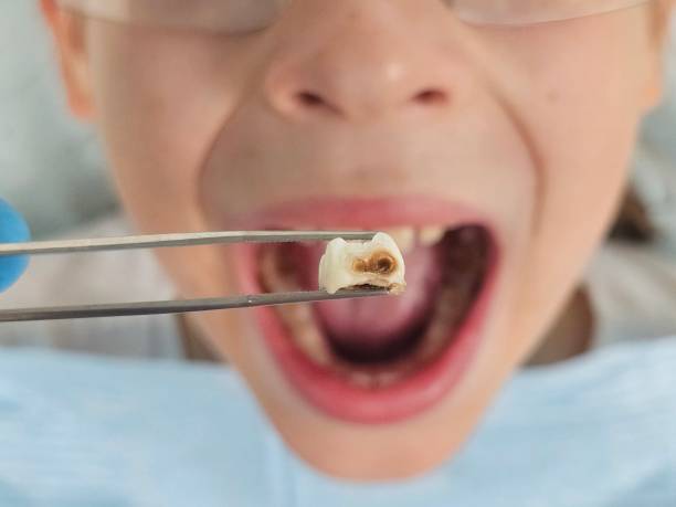 Best Emergency Dental Services for Seniors in Heidelberg, TX