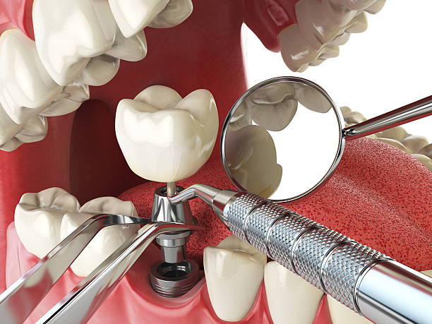 Best Broken or Cracked Tooth Emergency Dentist in Heidelberg, TX